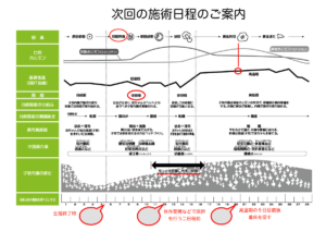 「体外受精と鍼灸施術」